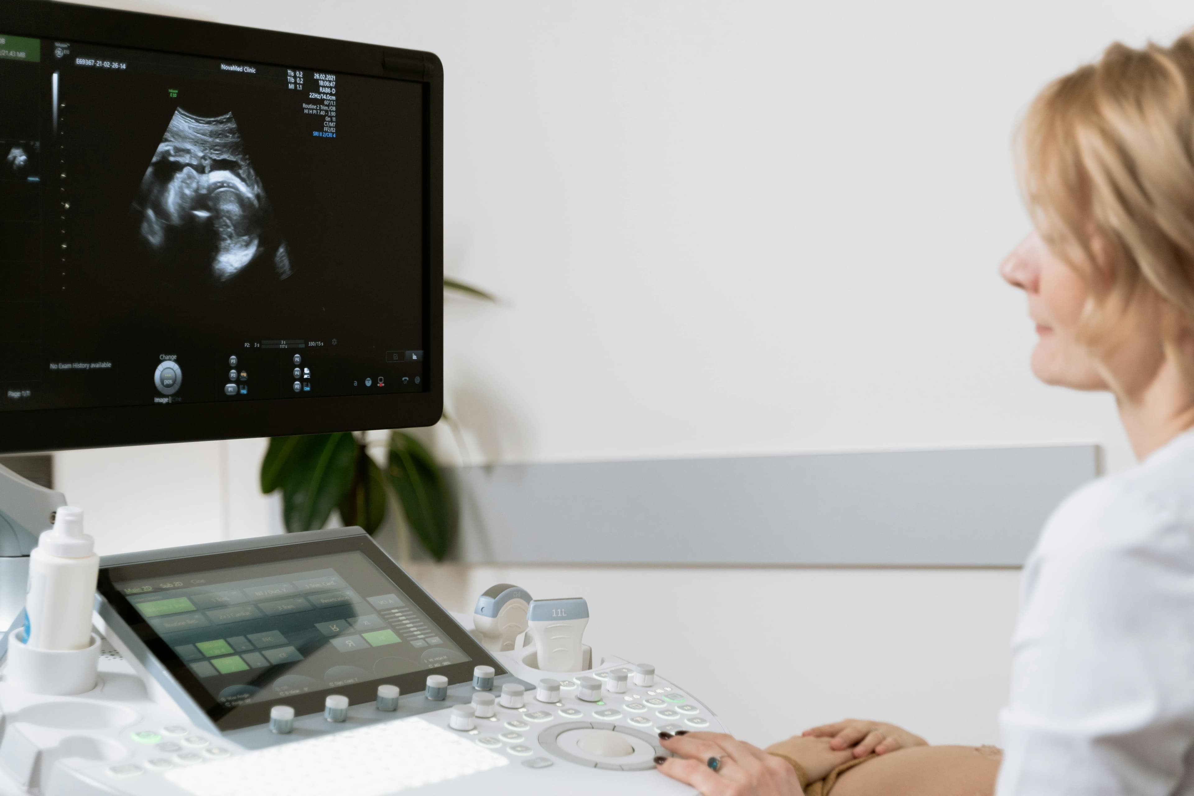 GE HealthCare Ultrasound Comparison: Voluson vs. Logiq Series